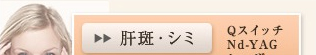 タトゥー QスイッチNd-YAGレーザー